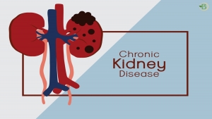 Natural Solutions for Chronic Kidney Disease: Homeopathy and Alternatives to Dialysis