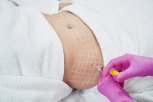 Look and Feel Your Best with Fat Melting Injections in Dubai
