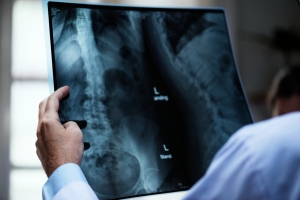 Finding the Best X-Ray Near Me Services at Affordable Prices