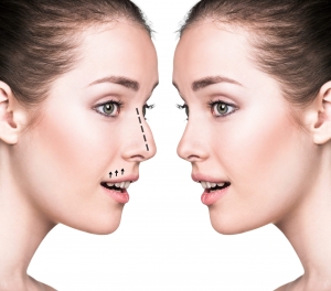 The Art of Great Rhinoplasty: Achieving Perfection