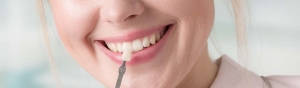 Everything You Need to Know About Non-Prep Veneers and Their Benefits