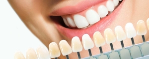 Why Non-Prep Veneers Are a Great Alternative to Traditional Veneers