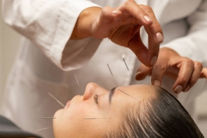 Can Acupuncture Relieve Migraines?