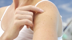 Lamellar Ichthyosis Market will grow at owing to increasing research and development activities