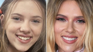 BEST CELEBRITY NOSE JOBS: TRANSFORMATIONS THAT INSPIRE