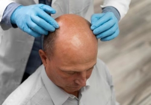 Is Hair Transplant Painful?