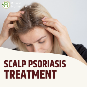 Natural Treatment for Psoriasis: Safe and Effective Homeopathic Solutions