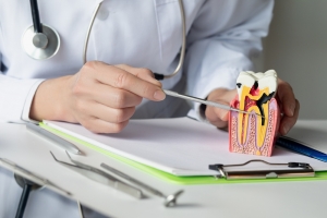 What Is a Root Canal and Why Do You Need One?