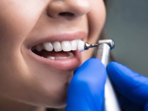 Professional Dental Cleaning Near Me | Get a Healthy, Clean Smile Today