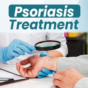 Natural Remedy for Psoriasis: Proven Methods to Stop Flare-Ups
