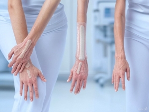 Understanding Arthritis: Causes, Types, and Treatment Options