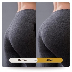 Best Butt Fillers in Dubai – Safe & Natural Results