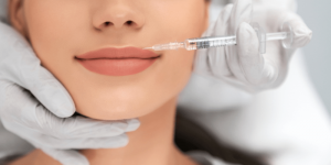 Everything You Need to Know About Lip Fillers in Raleigh, NC