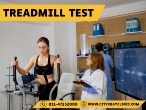 Understanding TMT Test Price Delhi: A Complete Guide