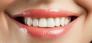 Whitening Your Teeth Safely: Tips from the Experts