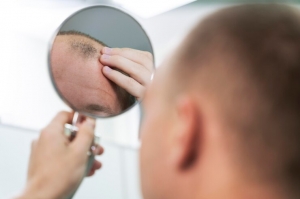 Can Alopecia Areata Be Cured with a Hair Transplant?