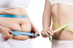 Post-Bariatric Surgery Recovery Tips from Kolkata Experts