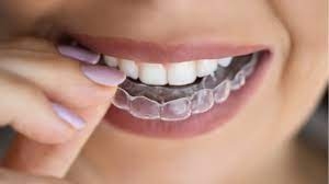 Night Guard Splints, A Simple Solution for Teeth Clenching