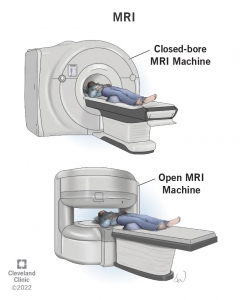 What Are the Main Parts of an MRI Machine?