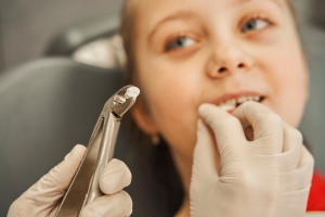 Why Timely Dental Extractions Are Crucial for Your Smile