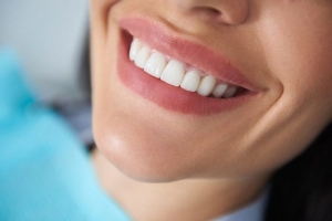 Tooth Whitening Treatment in Ipswich: A Comprehensive Guide