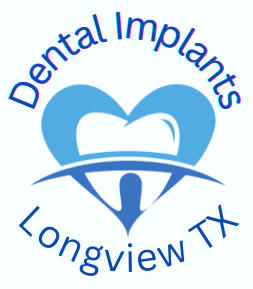 Longviewtx DentalImplants 