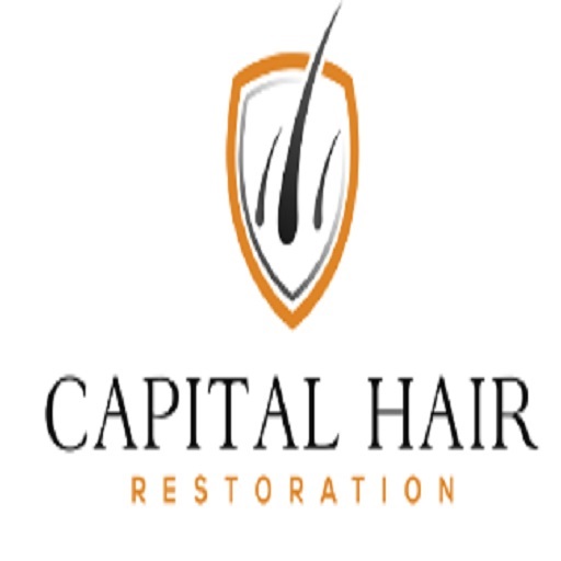 guildford hairtransplant