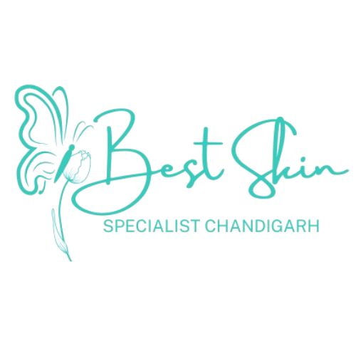 Specialist Chandigarh Best Skin 