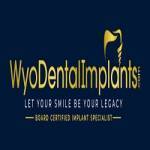 Dental Implants Wyoming