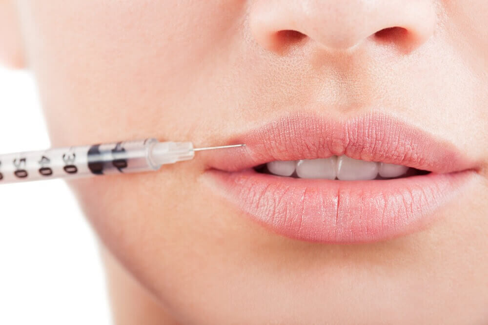 Lip Fillers Dubai