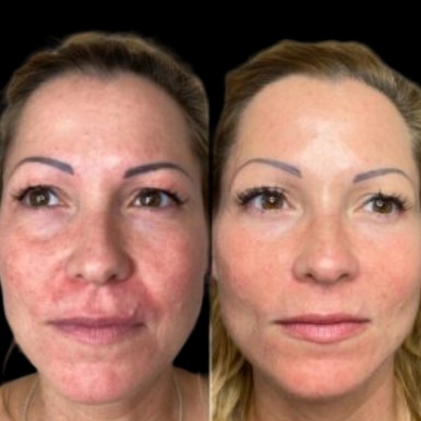 Treatments Skincare