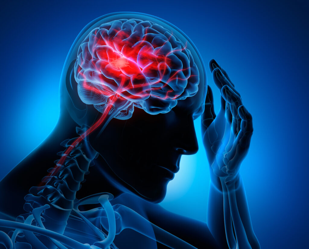 Craniaa  Neuro Rehab Centre