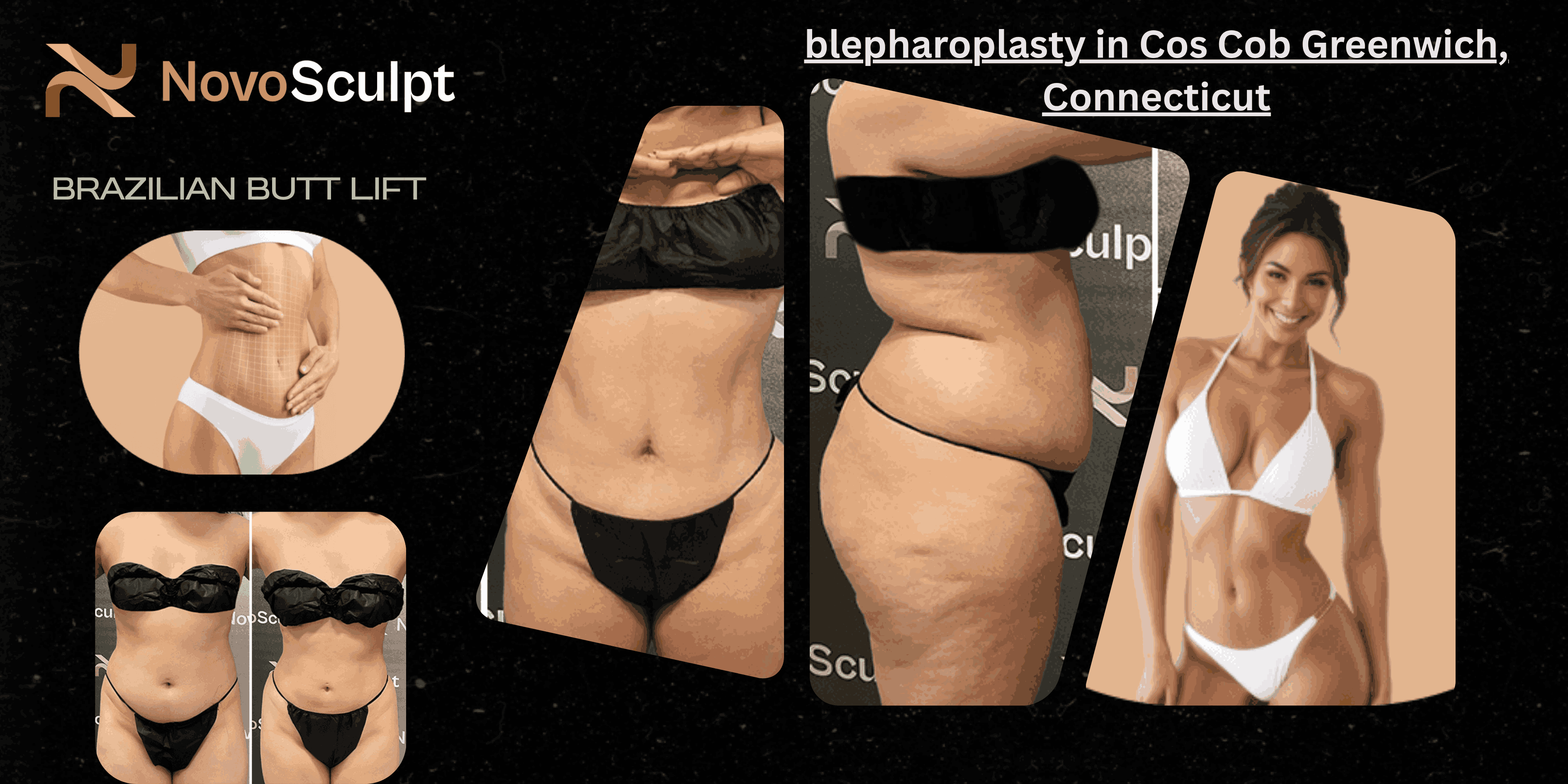 Novo Sculpt