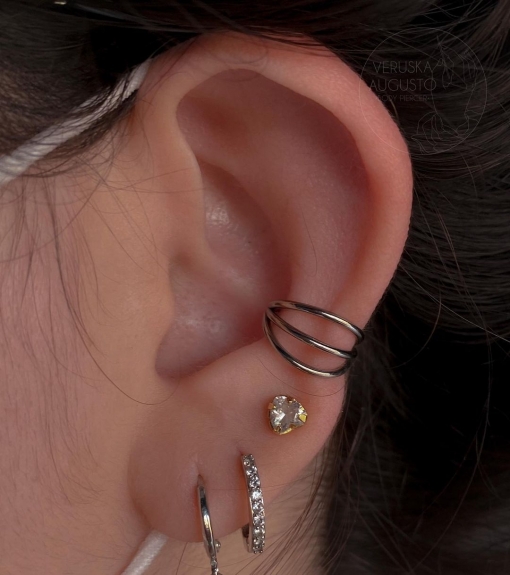 What is the Common Problems After Ear Piercing ?