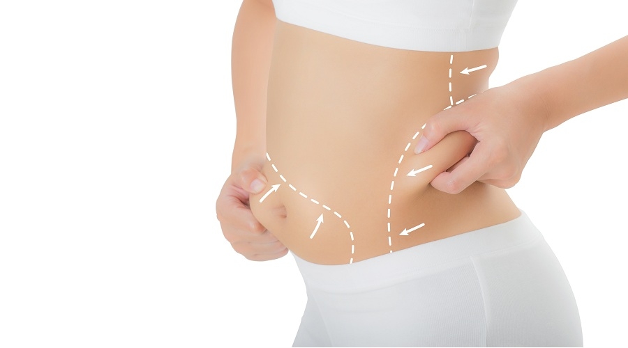 The Ultimate Liposuction Experience