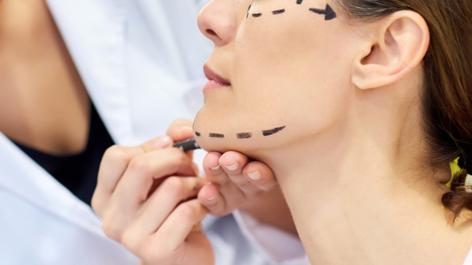 How Does Facelift Surgery Impact Facial Expression