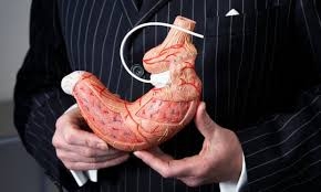 The Ultimate Guide to Gastric Band Surgery at Dynamic Clinic Dubai