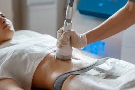 Radiant Results: Lipo Cavitation's Impact in Dubai