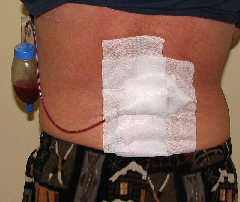 Cutting-edge Hernia Repair Techniques in Dubai