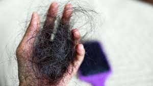More Than Just Braids: Hair Loss Solutions for Women	