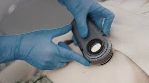 Innovative Dermoscopy Mole Screening in Dubai