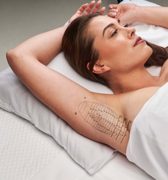 Beat the Heat: Miradry Solution for Excessive Sweating in Dubai