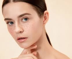 Treating Hyperpigmentation: Options in Dubai