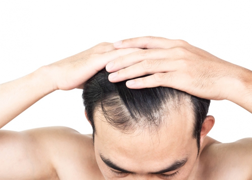 Discover the Latest Innovations in Front Line Hair Fixing Technology in Dubai