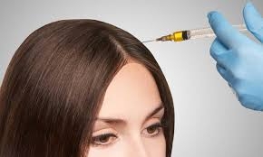 PRP for Hair Loss: Dubai's Top Treatment Option