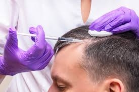 Benefits of PRP Hair Therapy in Dubai Revealed