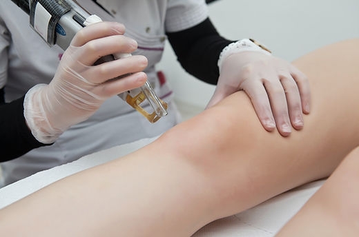What to Expect: CO2 Laser Treatment for Hypertrophic Scars in Dubai