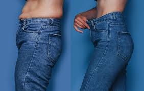 Liposuction Surgery Options in Dubai: What You Need to Know