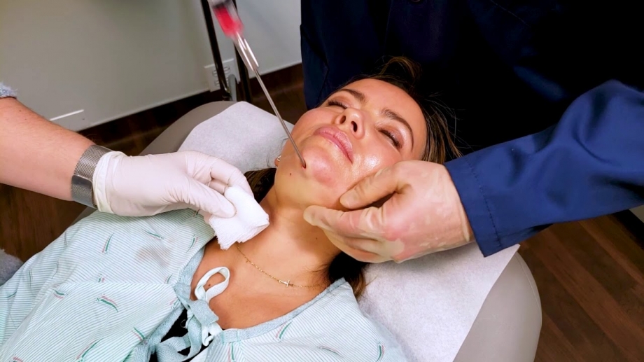 Is Double Chin Liposuction Right for You? Dubai Insights