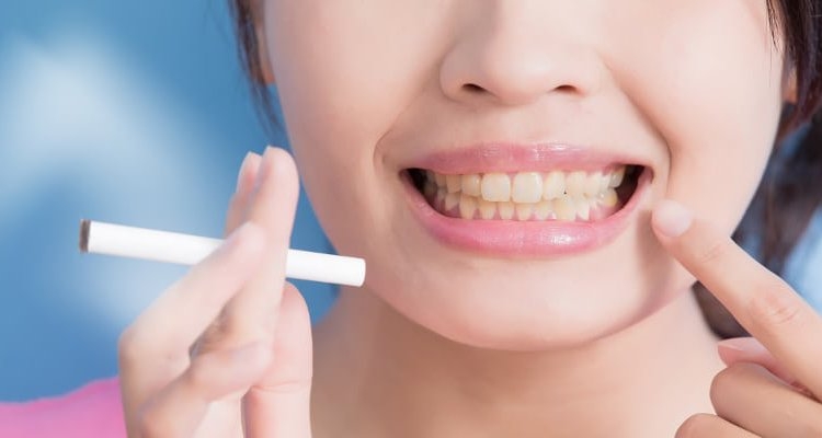 Is Teeth Whitening Effective for Smokers?